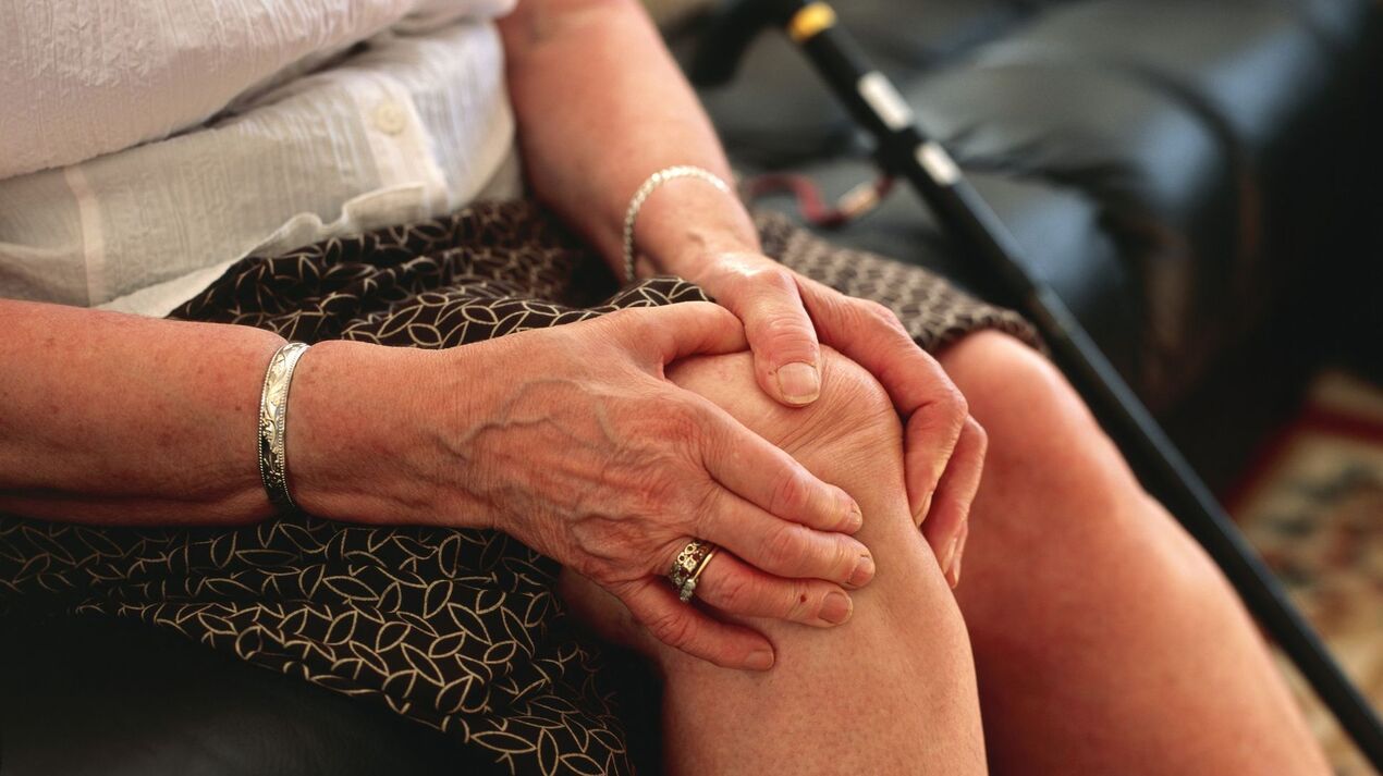 Knee osteoarthritis in an elderly woman