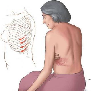pain in the ribs of the posterior part of the causes