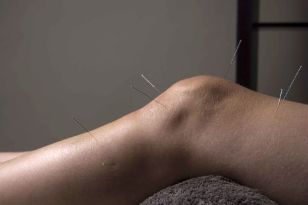 Acupuncture promotes joint tissue repair